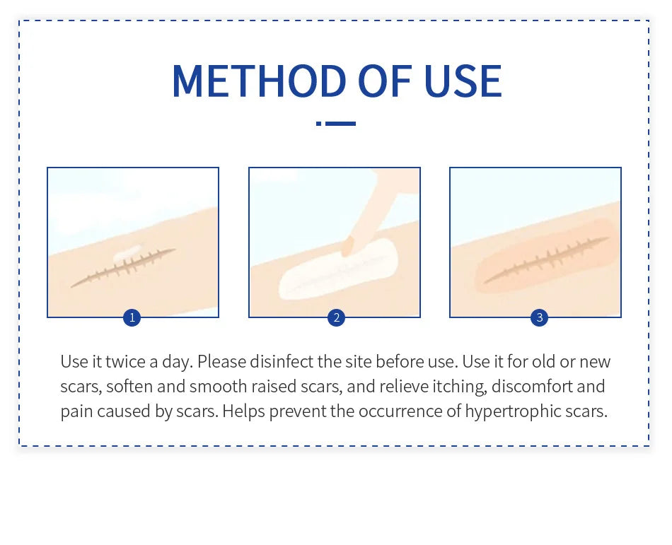 Scar Removal Cream Gel Remove Acne Spots Treatment Stretch Marks Burn Surgical Scar Repair Cream Smoothing Whitening Skin Beauty